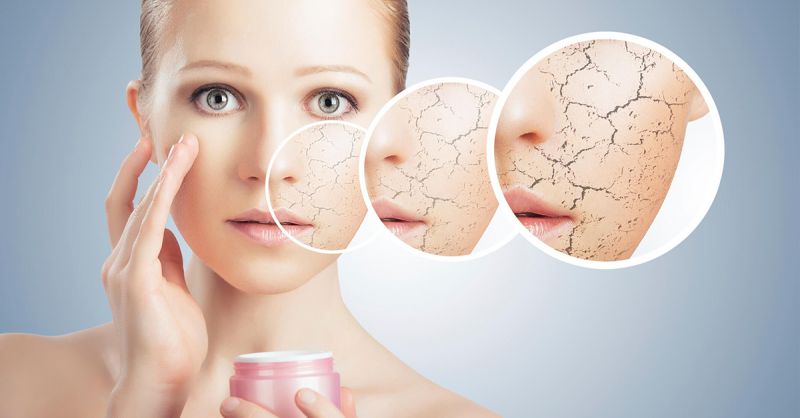 Những hiểu biết về tình trạng da khô